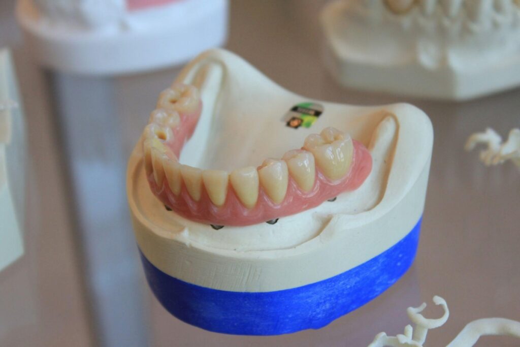 Factors to Consider Before Choosing Implants